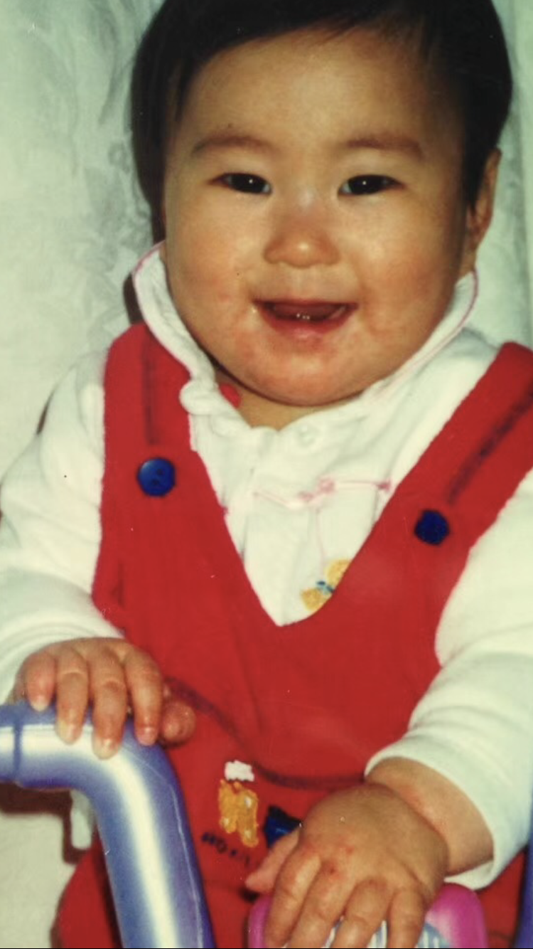 Baby photo showing eczema